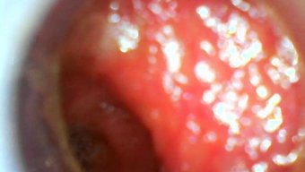 Usb Kamera, Samimi Alanın Derinliklerini Keşfediyor