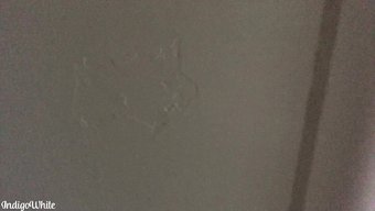 Beyaz Adam Hasta Kız Arkadaşını Rahatlatıyor