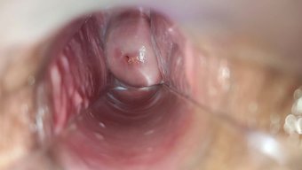 Bir Spekulum Ve Diğer Araçların Yardımıyla Vajinal Orgazm.